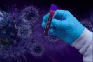 Viroložka: Ke koronaviru bychom měli přistupovat jako k chřipkové epidemii